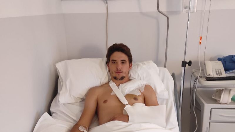 Diego Carretero operado con éxito de fractura de clavícula